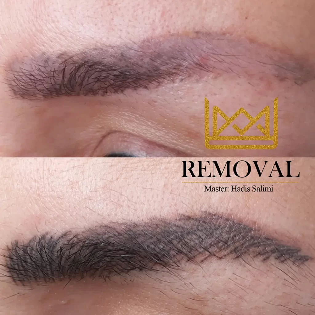 ریموو چشم و ابرو