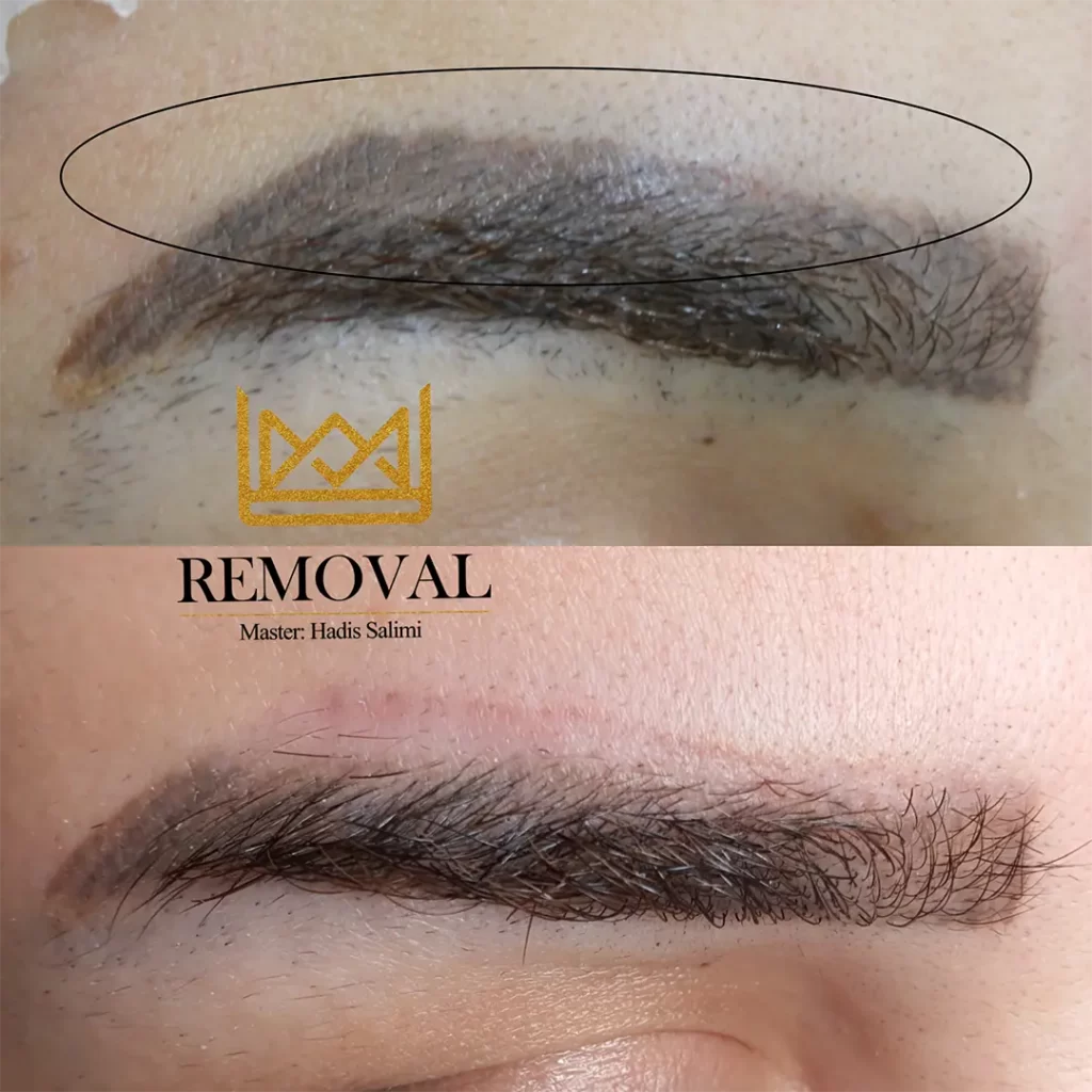 ریموو چشم و ابرو