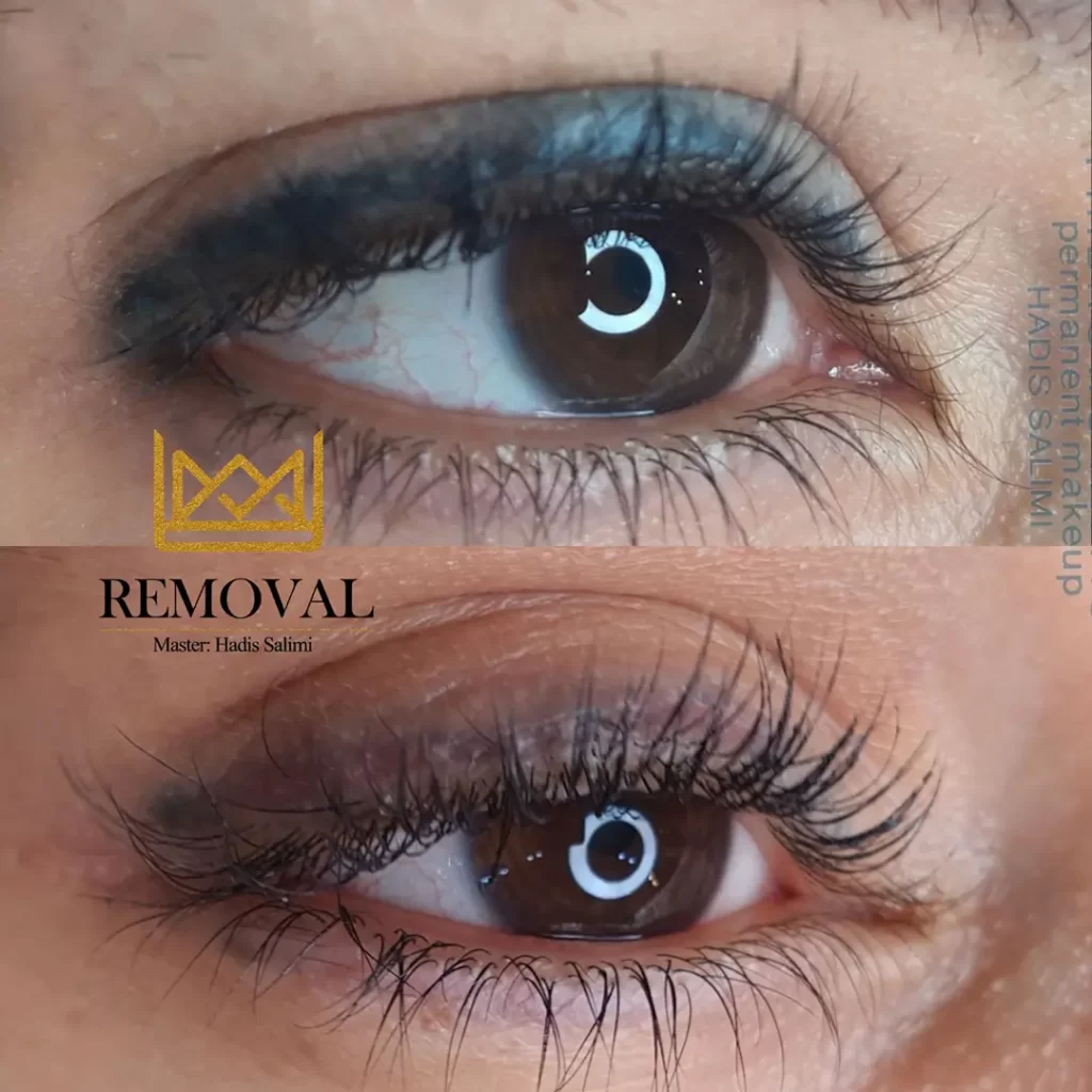 ریموو چشم و ابرو
