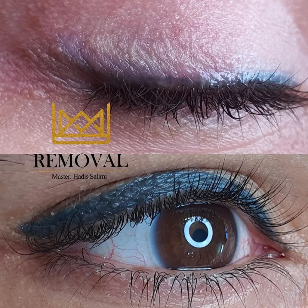 ریموو چشم و ابرو