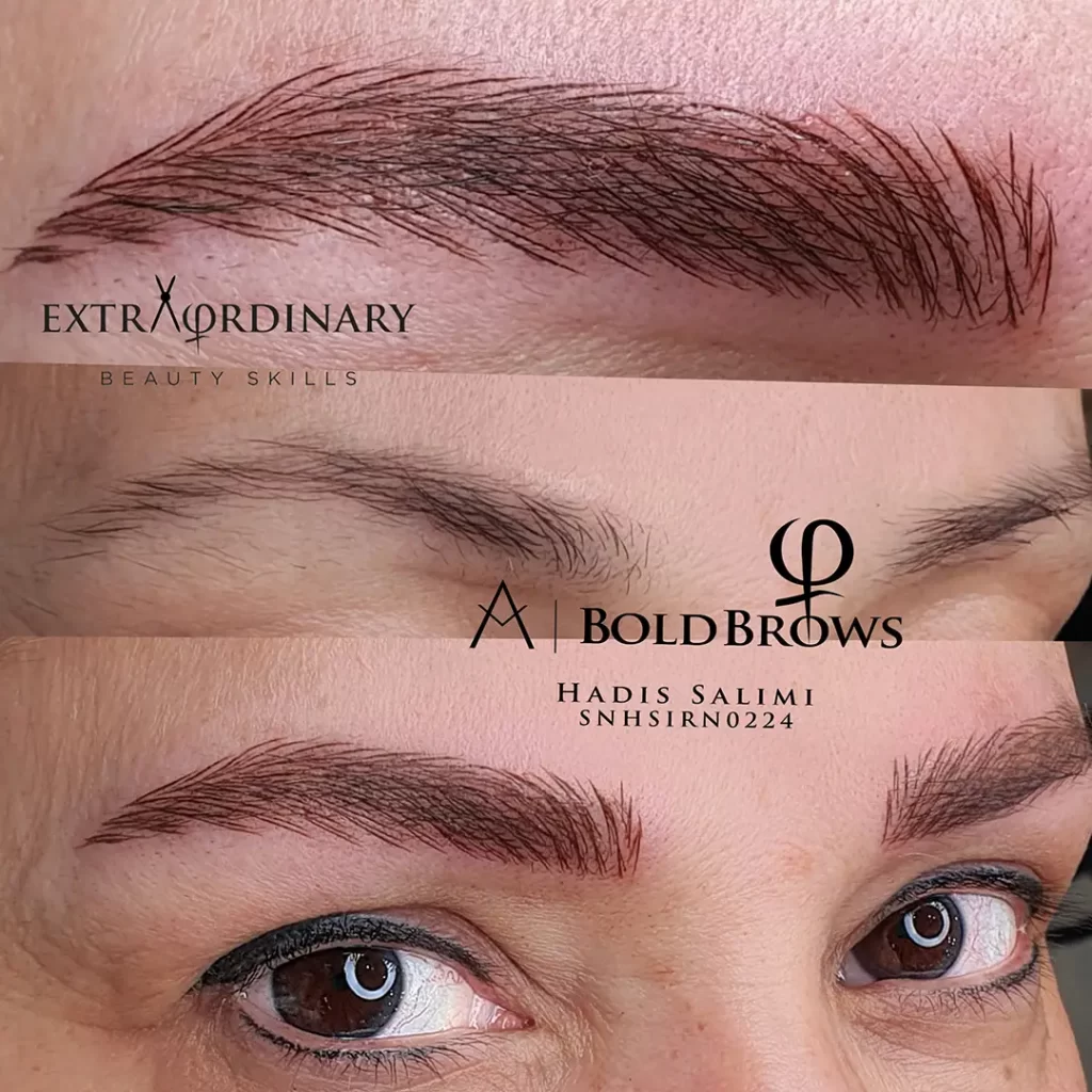 میکروبلیدینگ