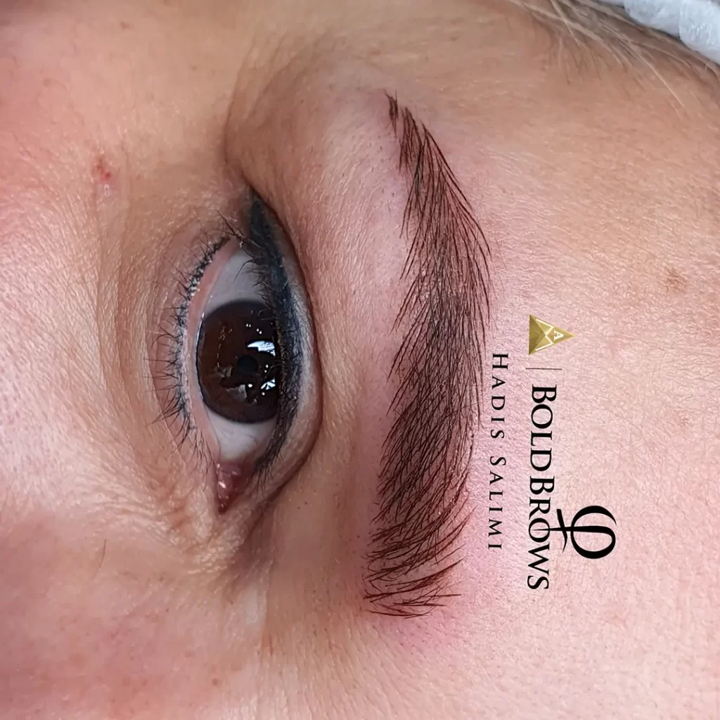 میکروبلیدینگ