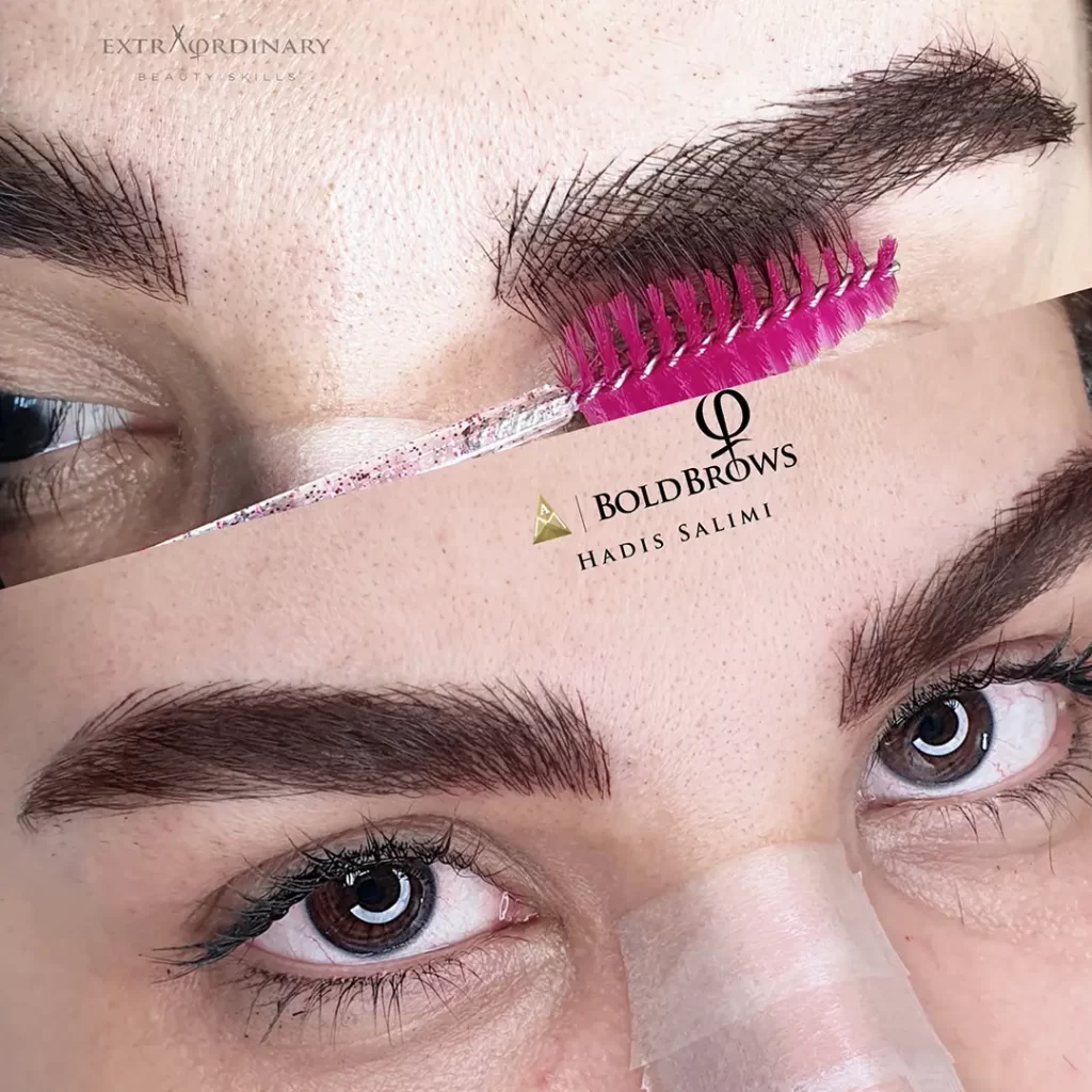 میکروبلیدینگ