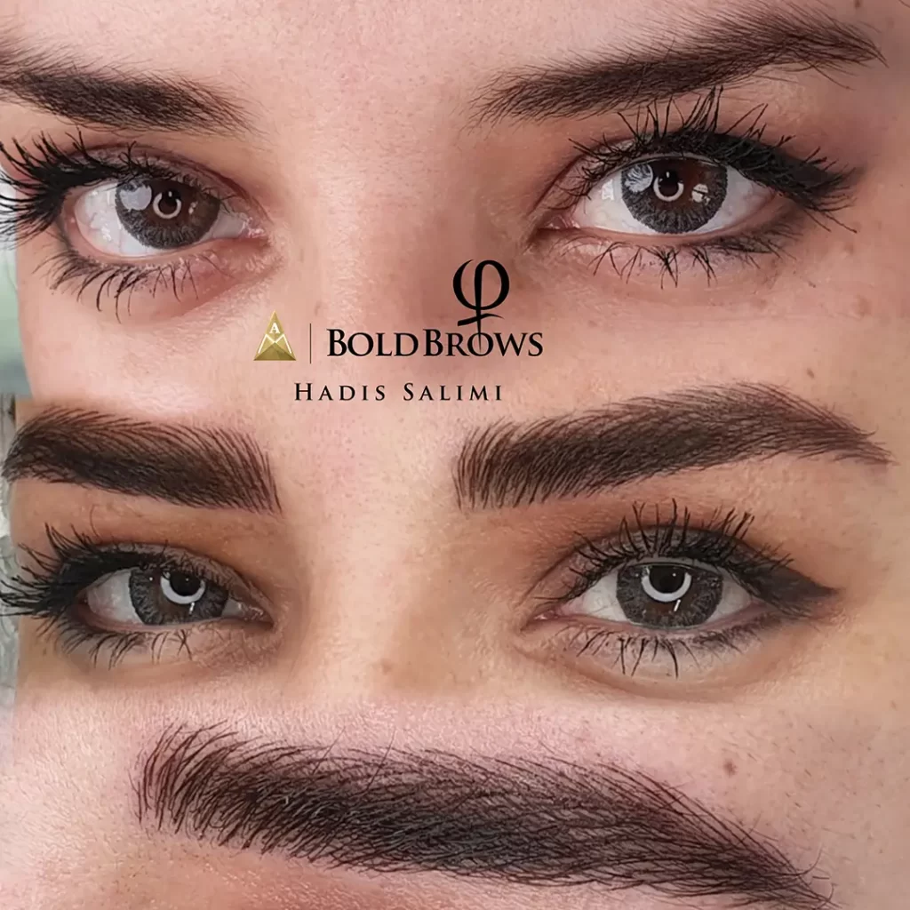 میکروبلیدینگ