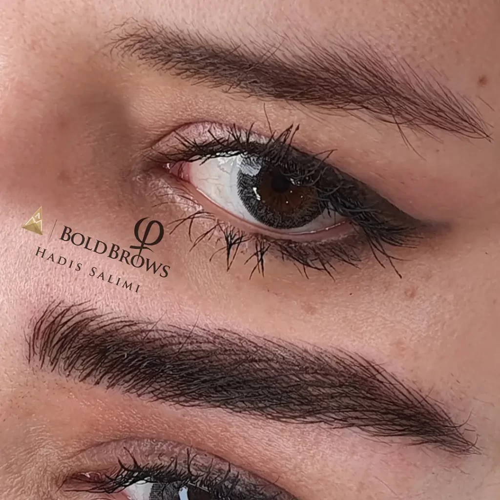 میکروبلیدینگ