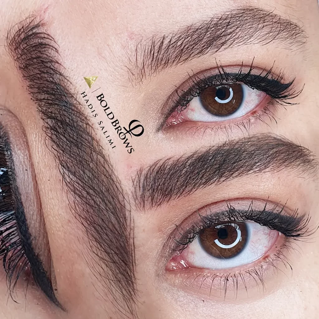 میکروبلیدینگ