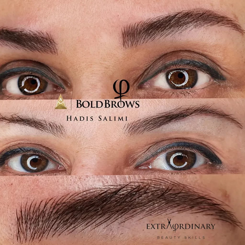 میکروبلیدینگ