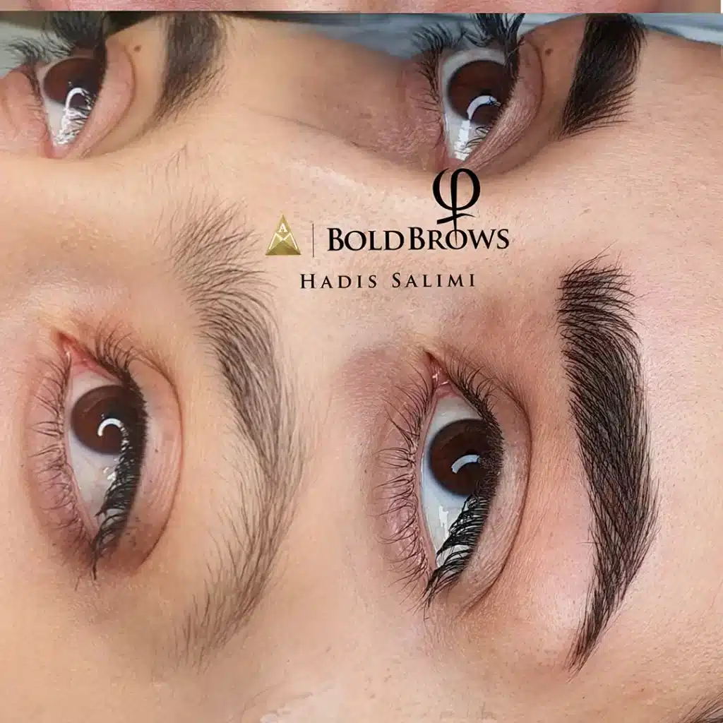 میکروبلیدینگ