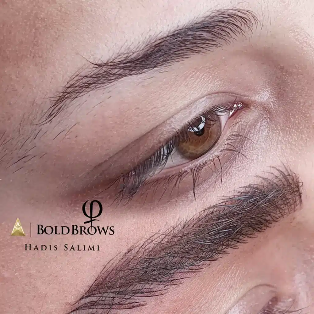 میکروبلیدینگ