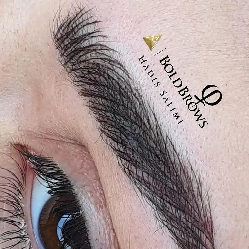 میکروبلیدینگ