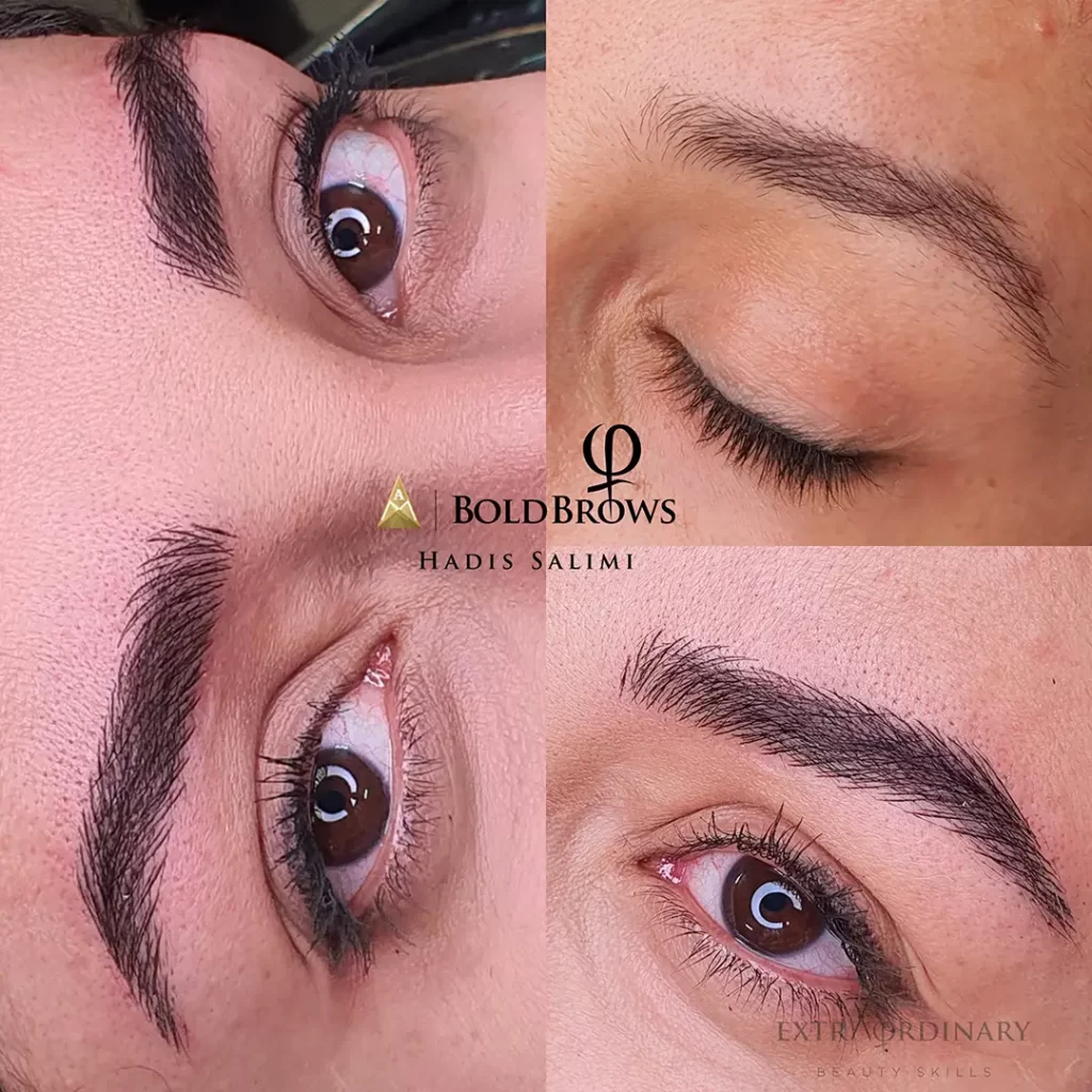 میکروبلیدینگ