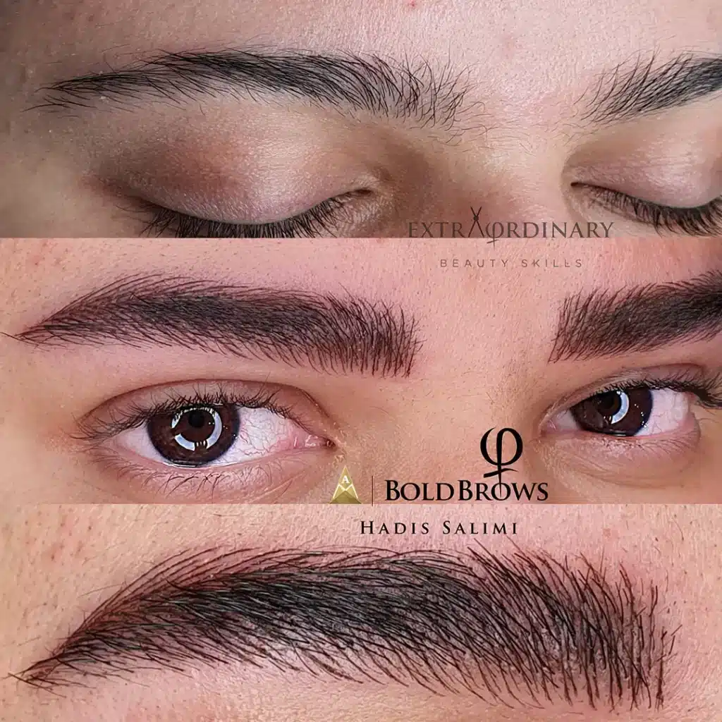 میکروبلیدینگ