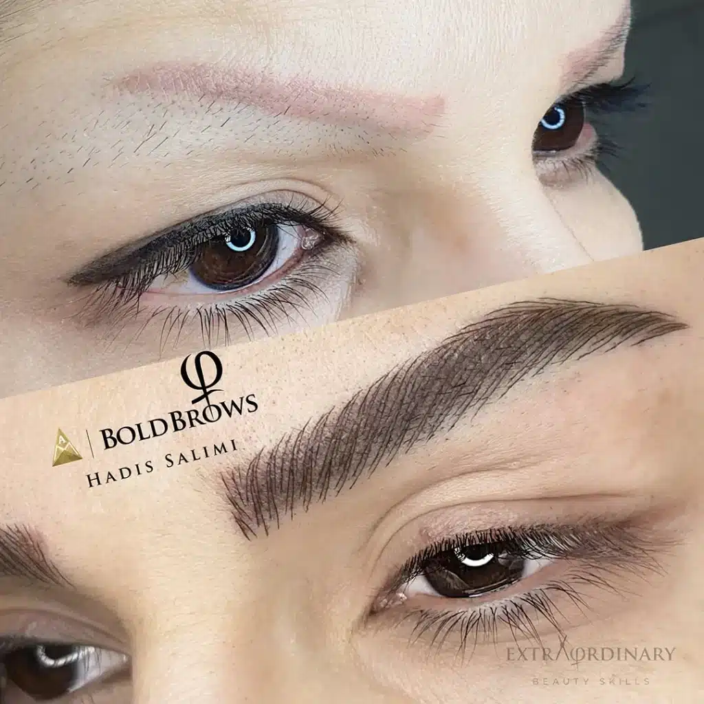 میکروبلیدینگ