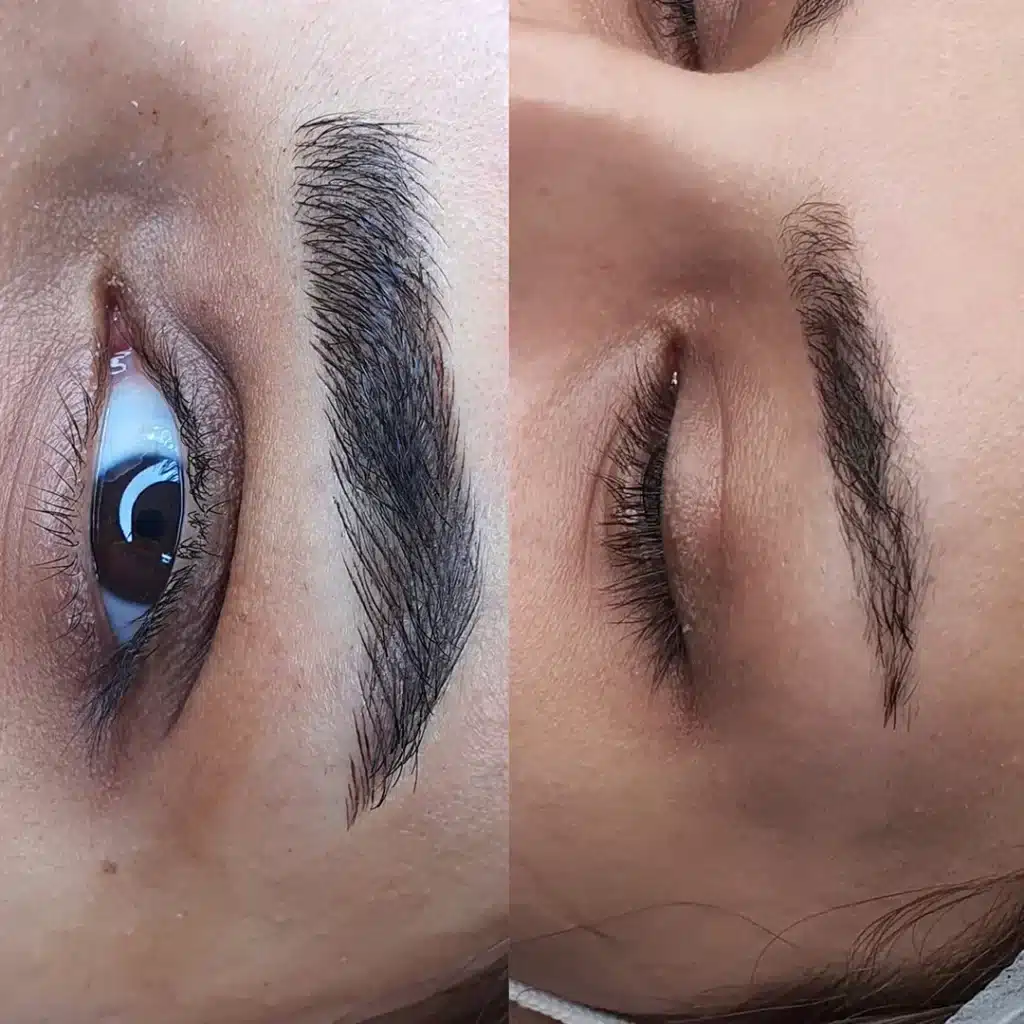 میکروبلیدینگ