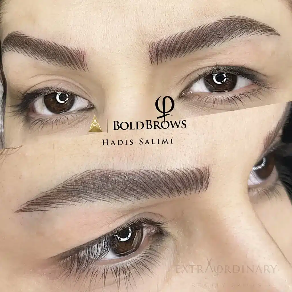 میکروبلیدینگ