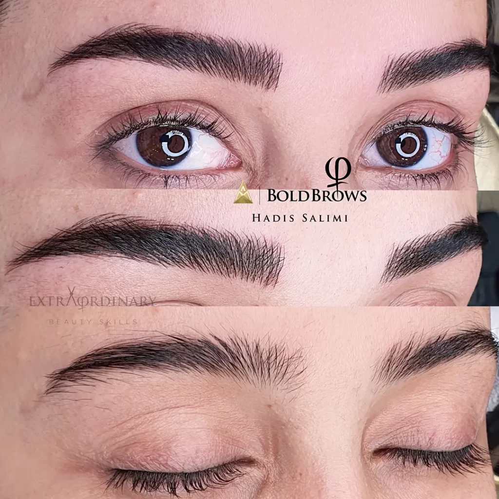 میکروبلیدینگ