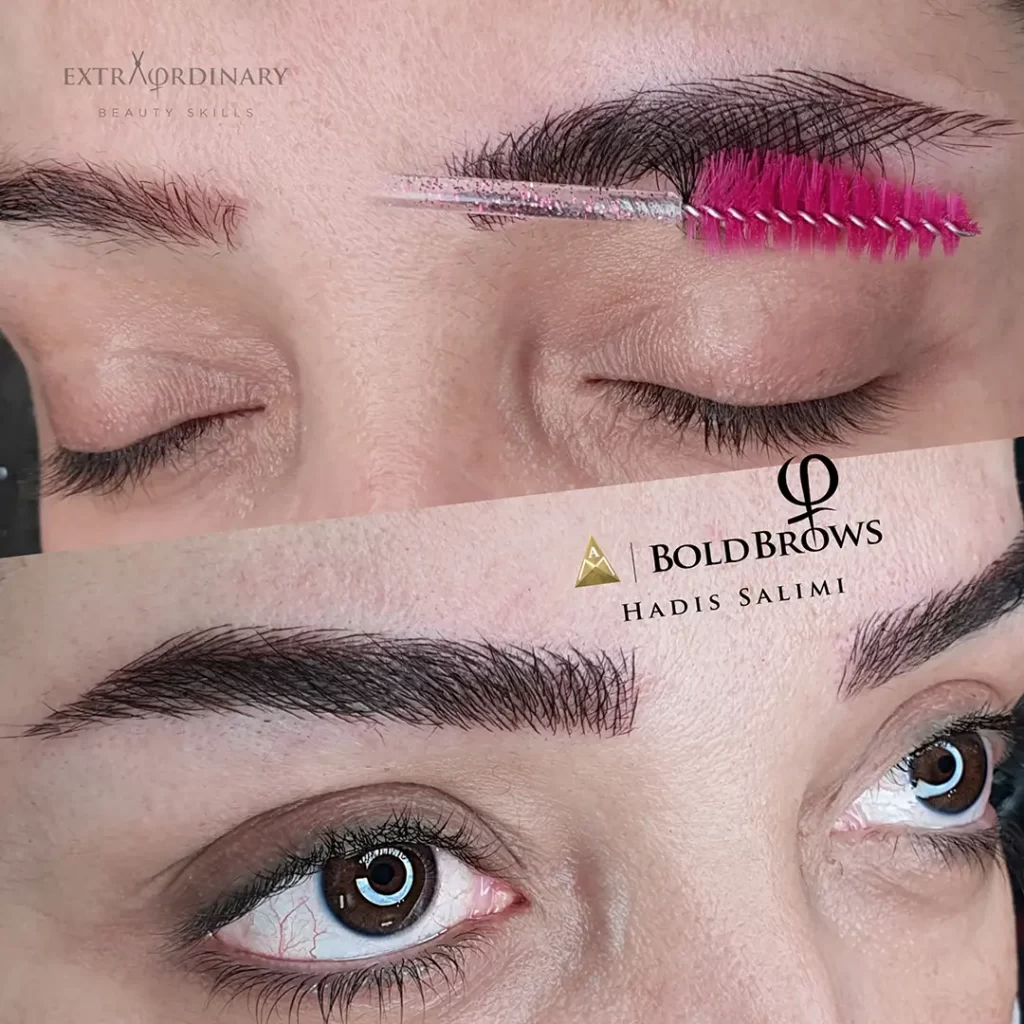 میکروبلیدینگ