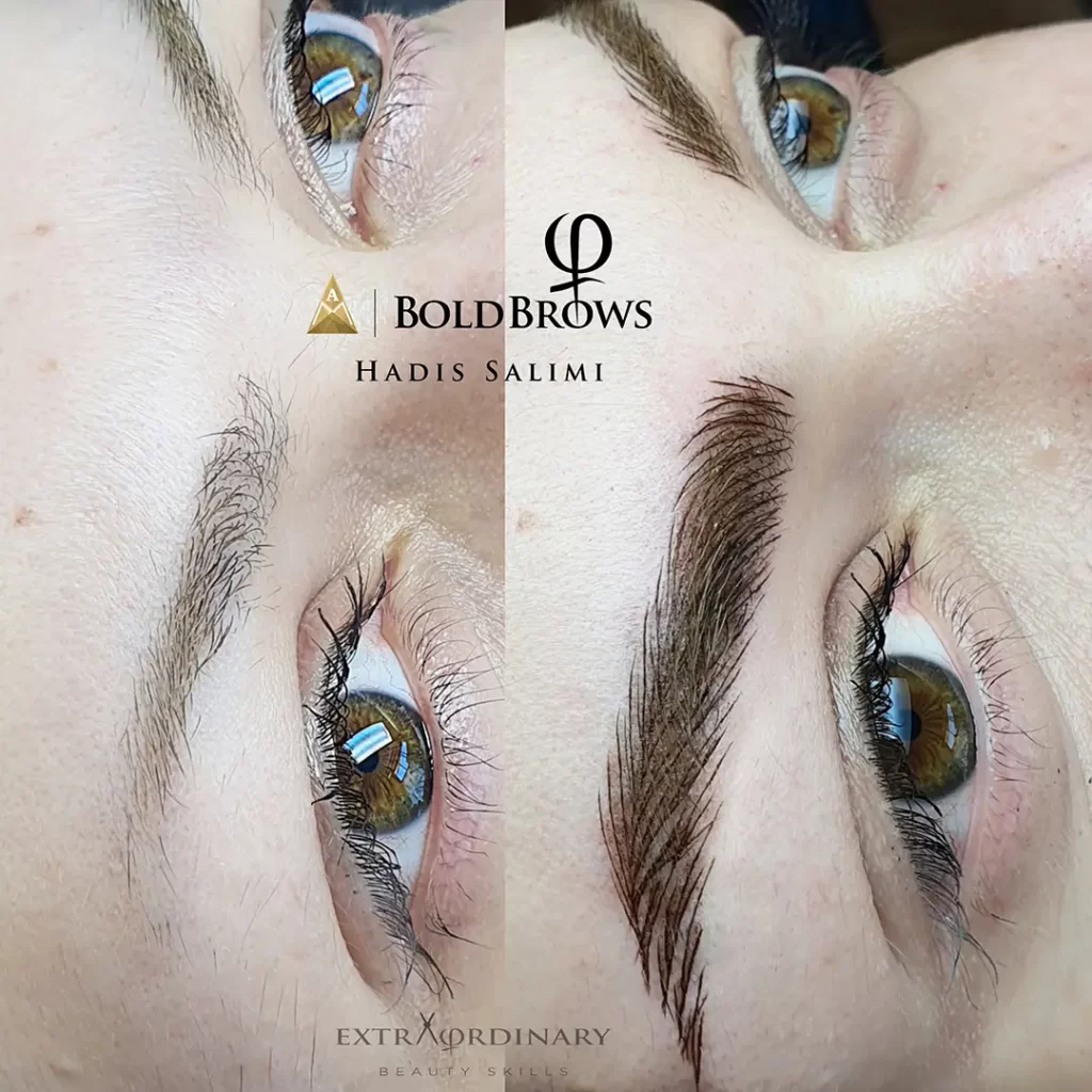 میکروبلیدینگ