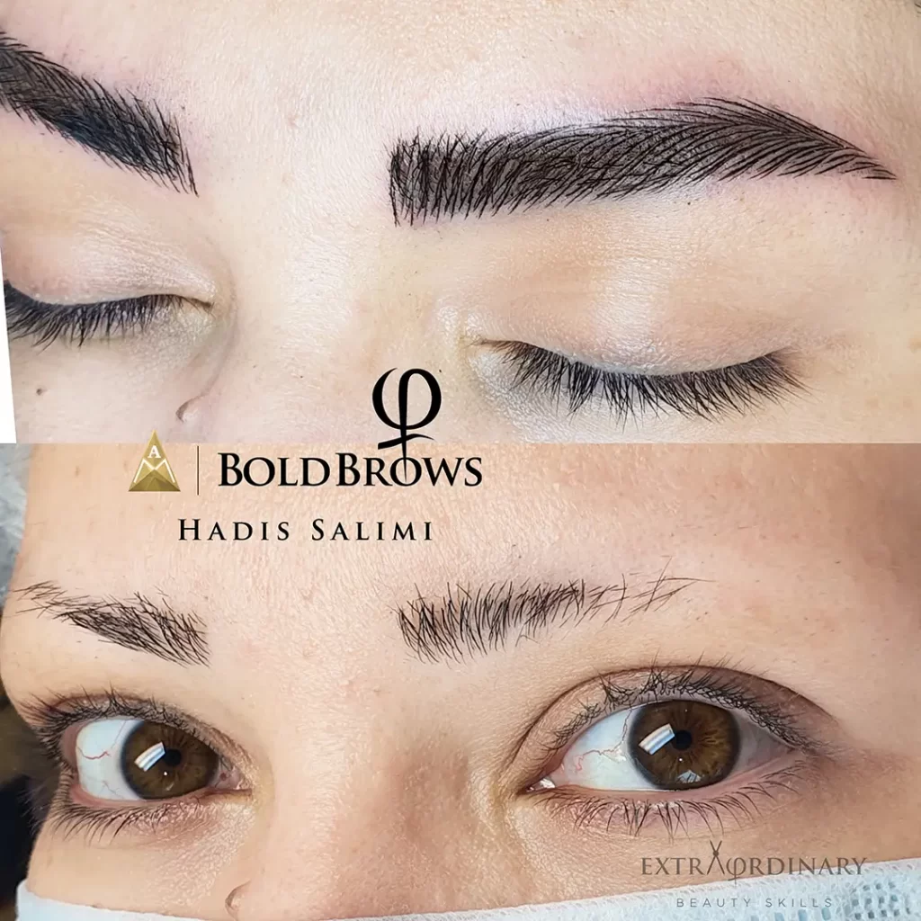 میکروبلیدینگ