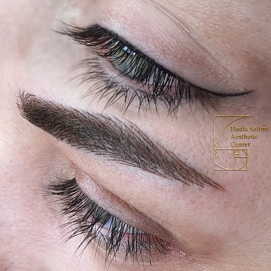 میکروبلیدینگ