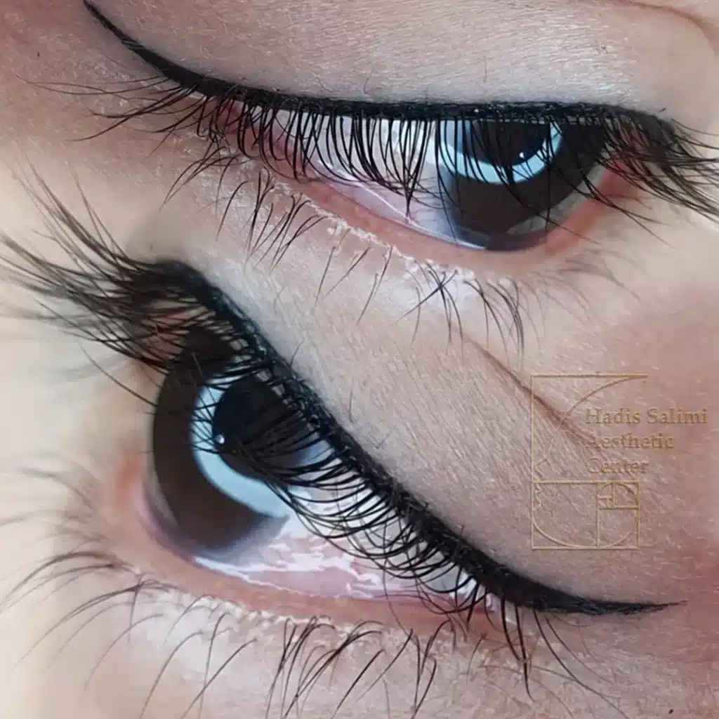 کانتورمینیاتوری