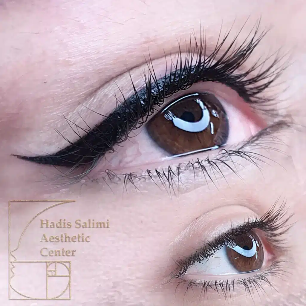 کانتورمینیاتوری