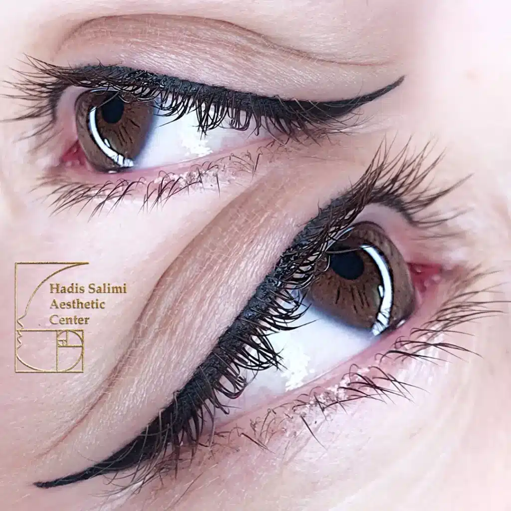 کانتورمینیاتوری