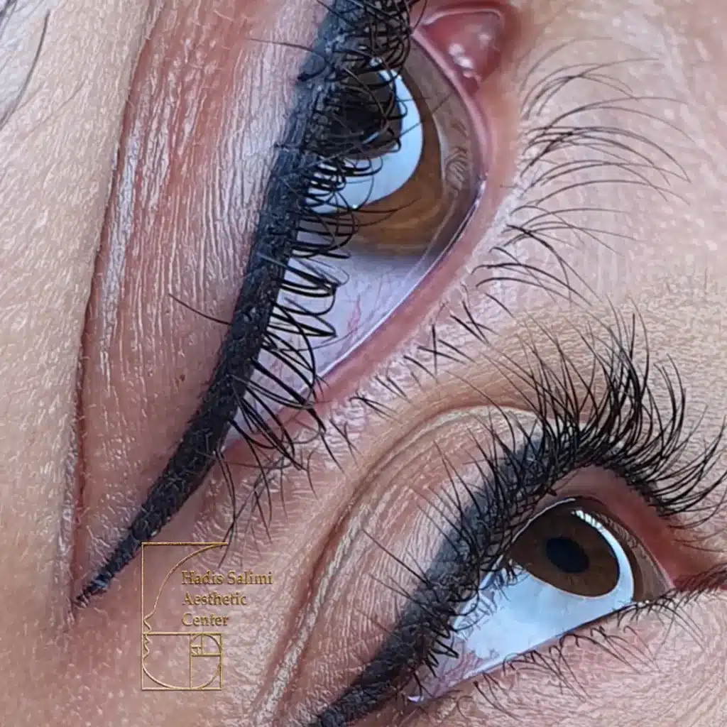 کانتورمینیاتوری