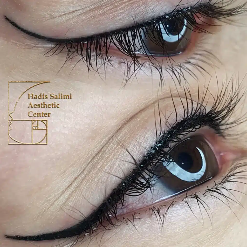 کانتورمینیاتوری