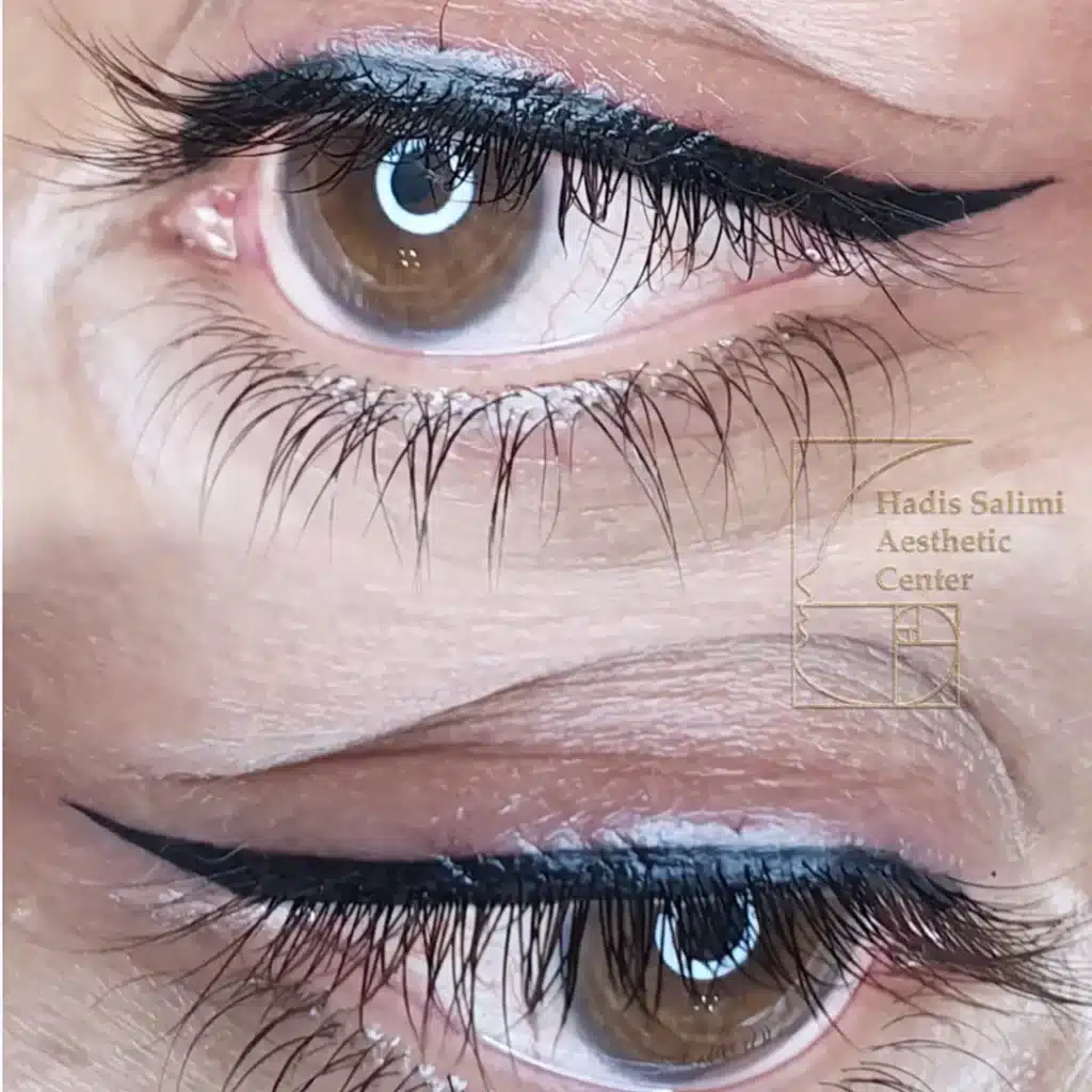 کانتورمینیاتوری