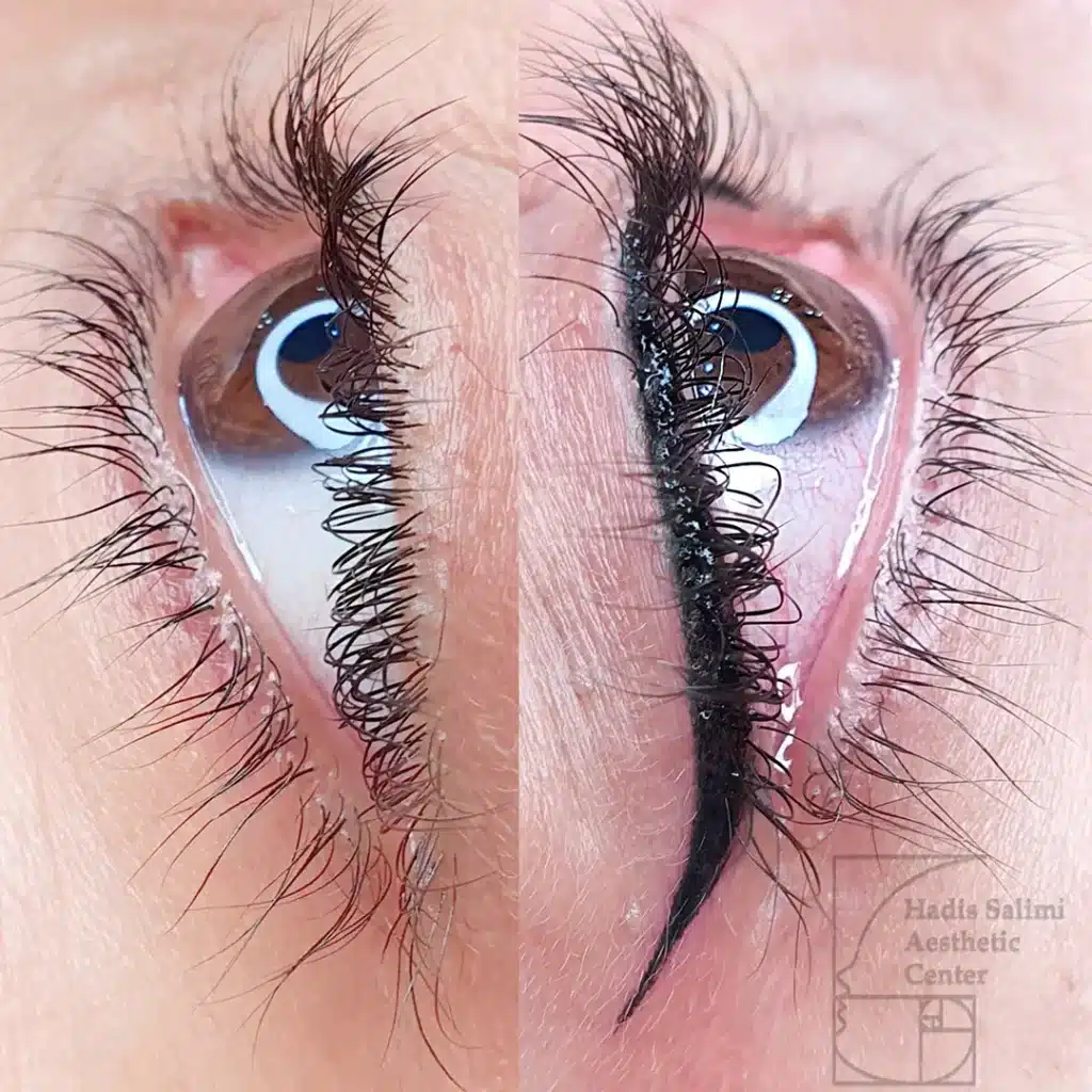 کانتورمینیاتوری