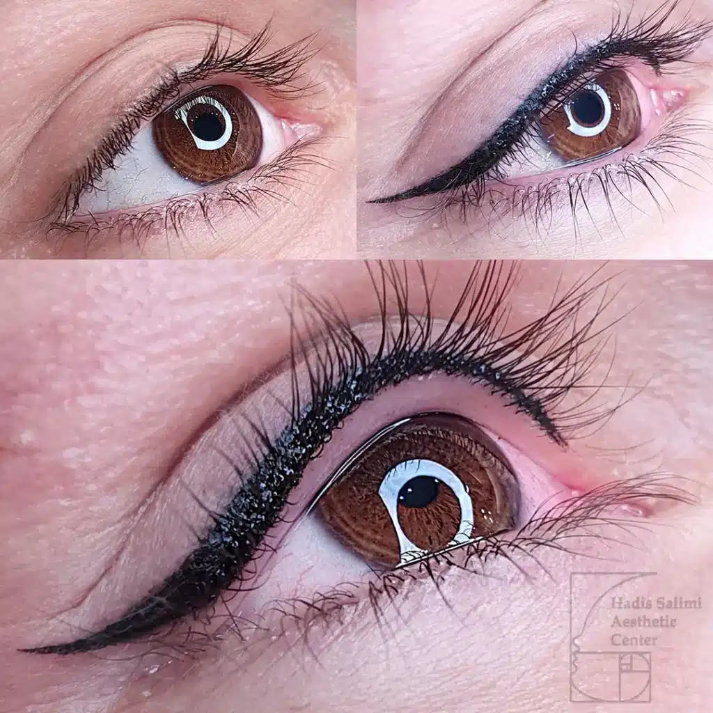 کانتورمینیاتوری