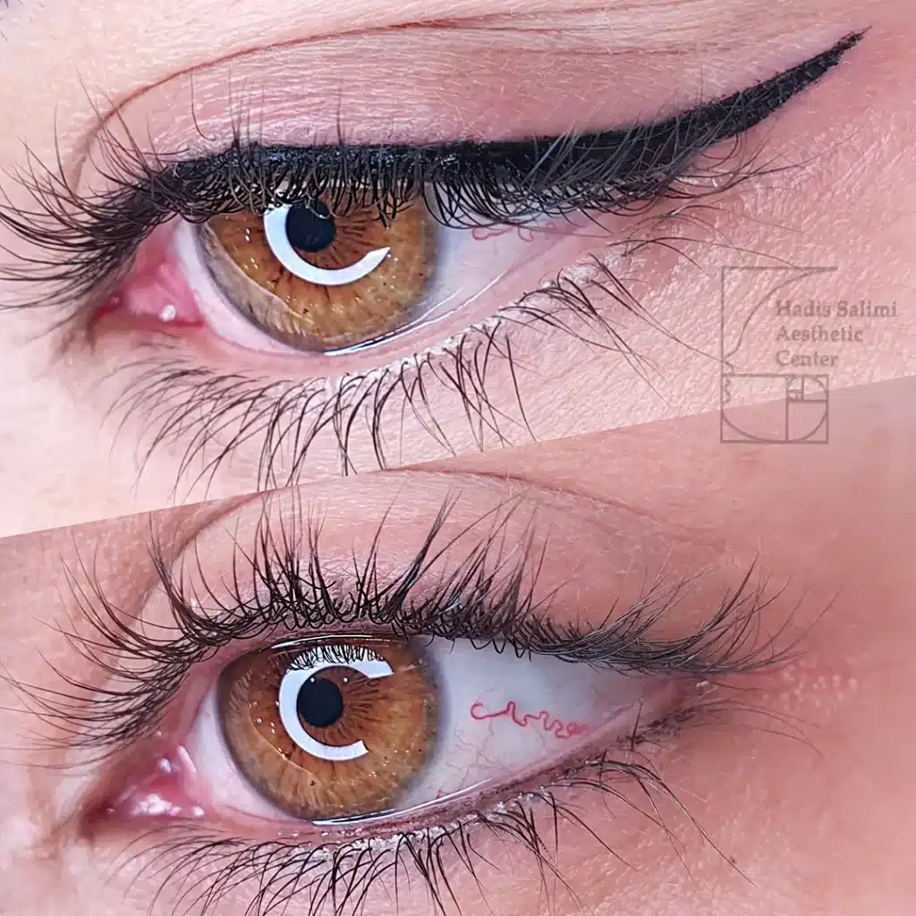 کانتورمینیاتوری