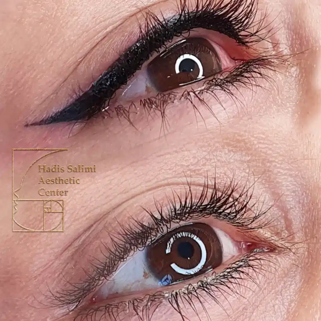 کانتورمینیاتوری