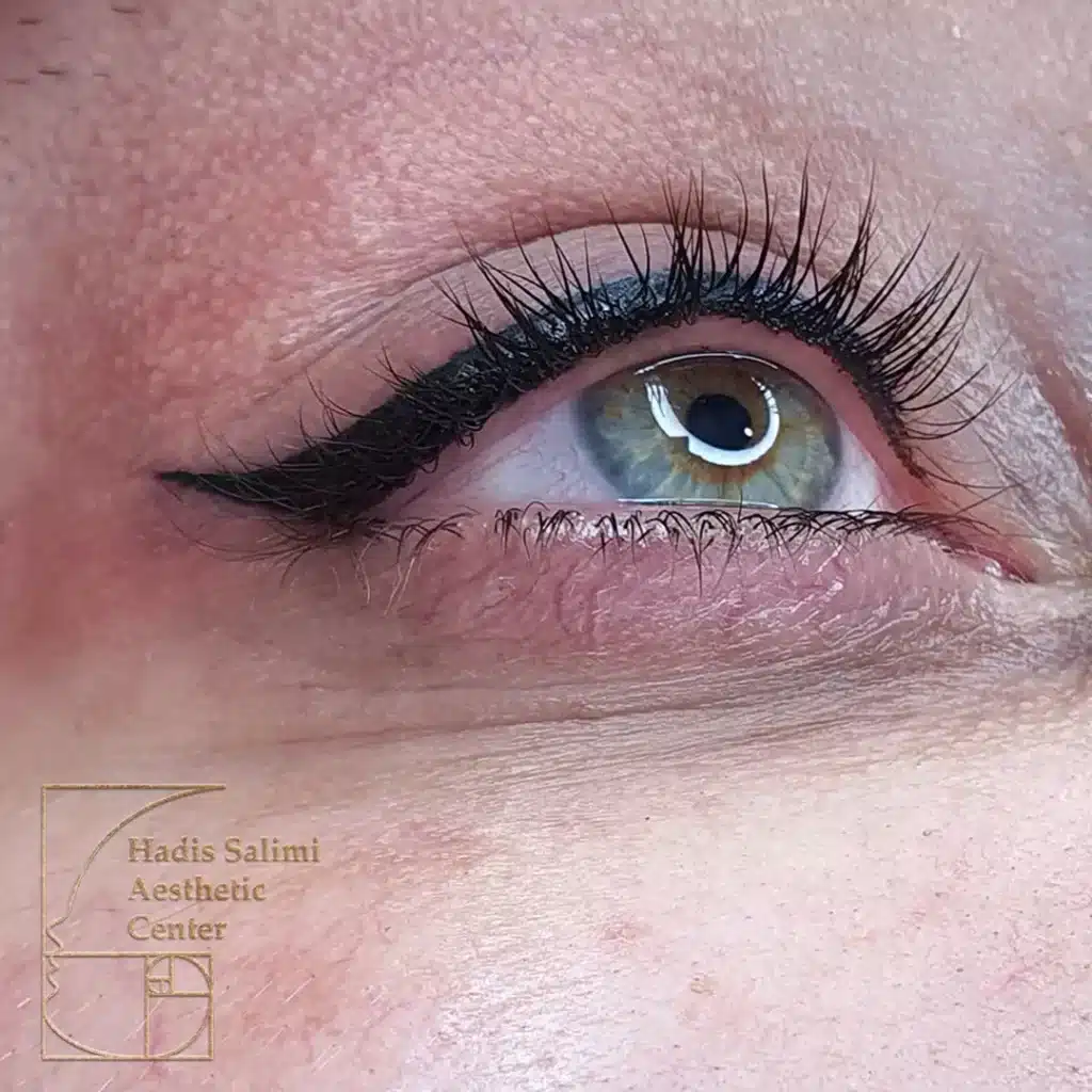 کانتورمینیاتوری