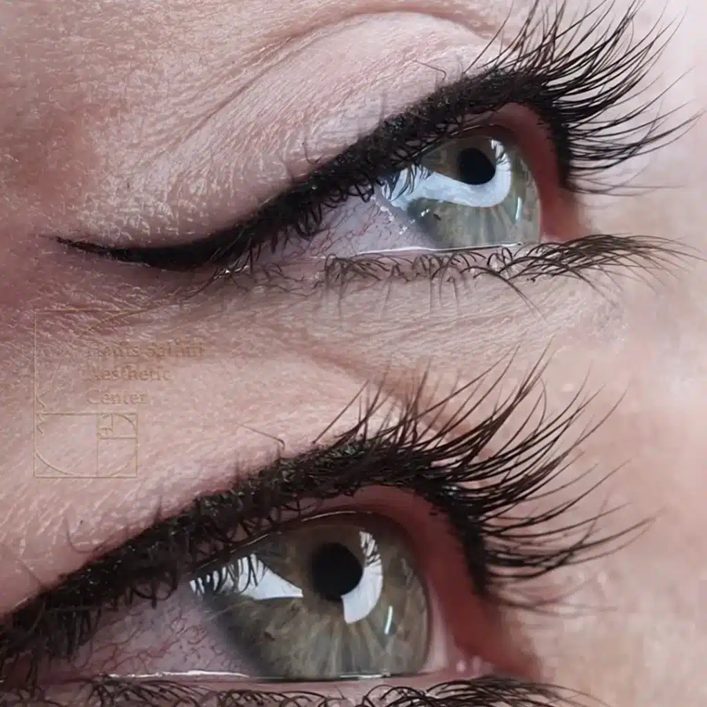 کانتورمینیاتوری