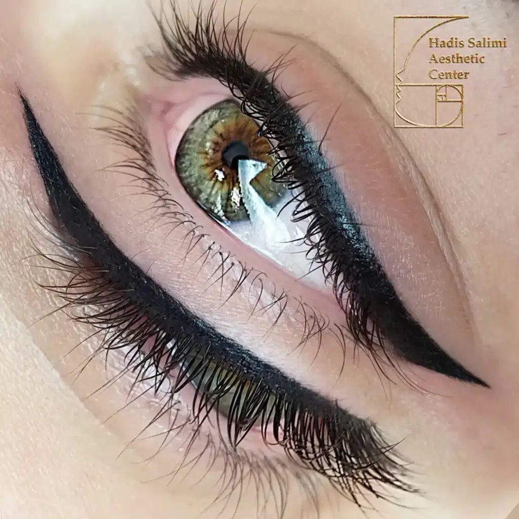 کانتورمینیاتوری